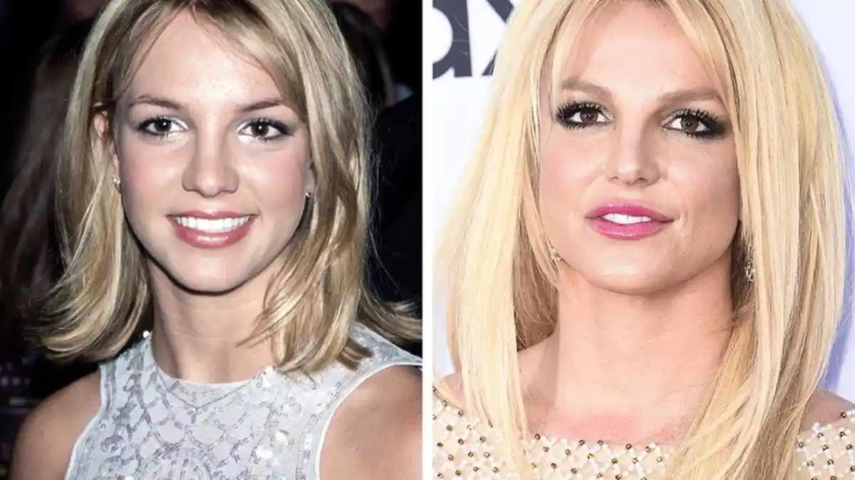 4 Seleb Hollywood Ini Pernah Operasi Plastik di Wajah, Britney Spears Senang Operasi Bibir