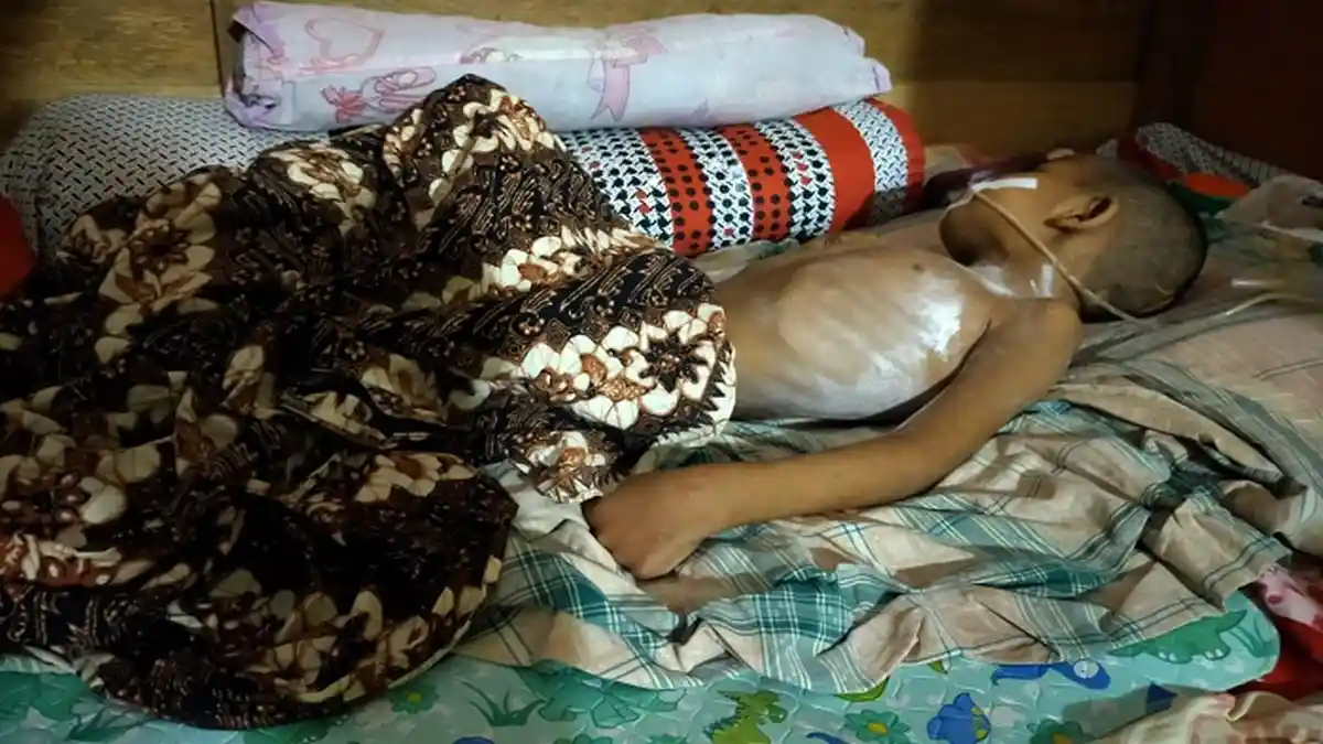 Fadil, Bocah yang Dulu Ceria, Kini Terbaring tidak Berdaya