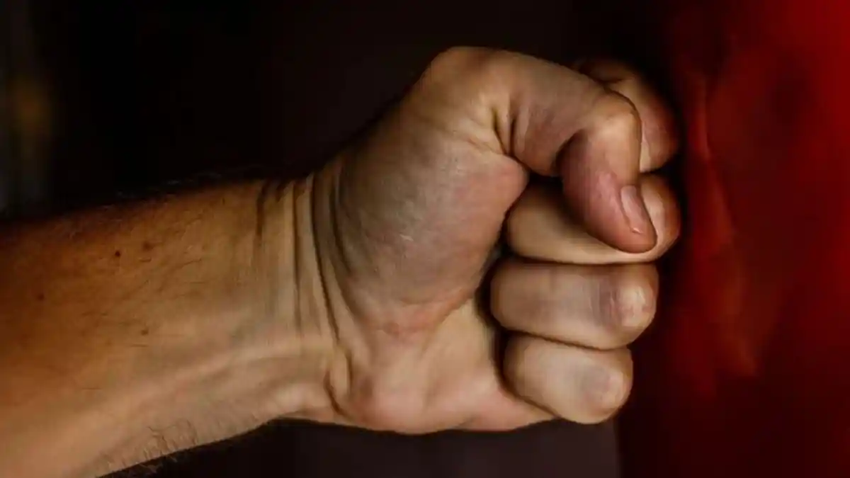 Kalah Taruhan, Suami Tega Siram Istri Pakai Cairan Asam Karena Tak Mau Dirudakpaksa Teman-Temannya