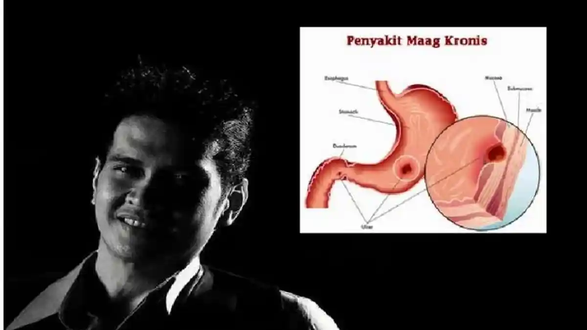 Ryan Thamrin dr Oz Meninggal - Ini Tanda-tanda Maag Akut Penyakit yang Diderita si Dokter Tampan