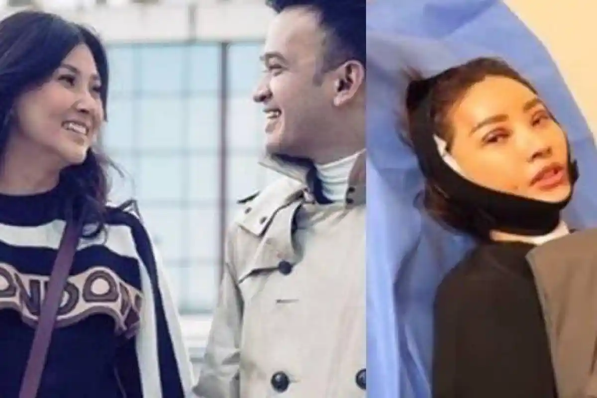 Alasan Sarwendah Operasi Plastik setelah Digugat Cerai Ruben Onsu: Kulitnya Kendur