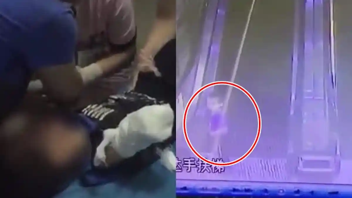 Tergelincir di Eskalator, Bocah 4 Tahun Ini Mengalami Hal Mengerikan, Baca Ini Sebelum Terlambat