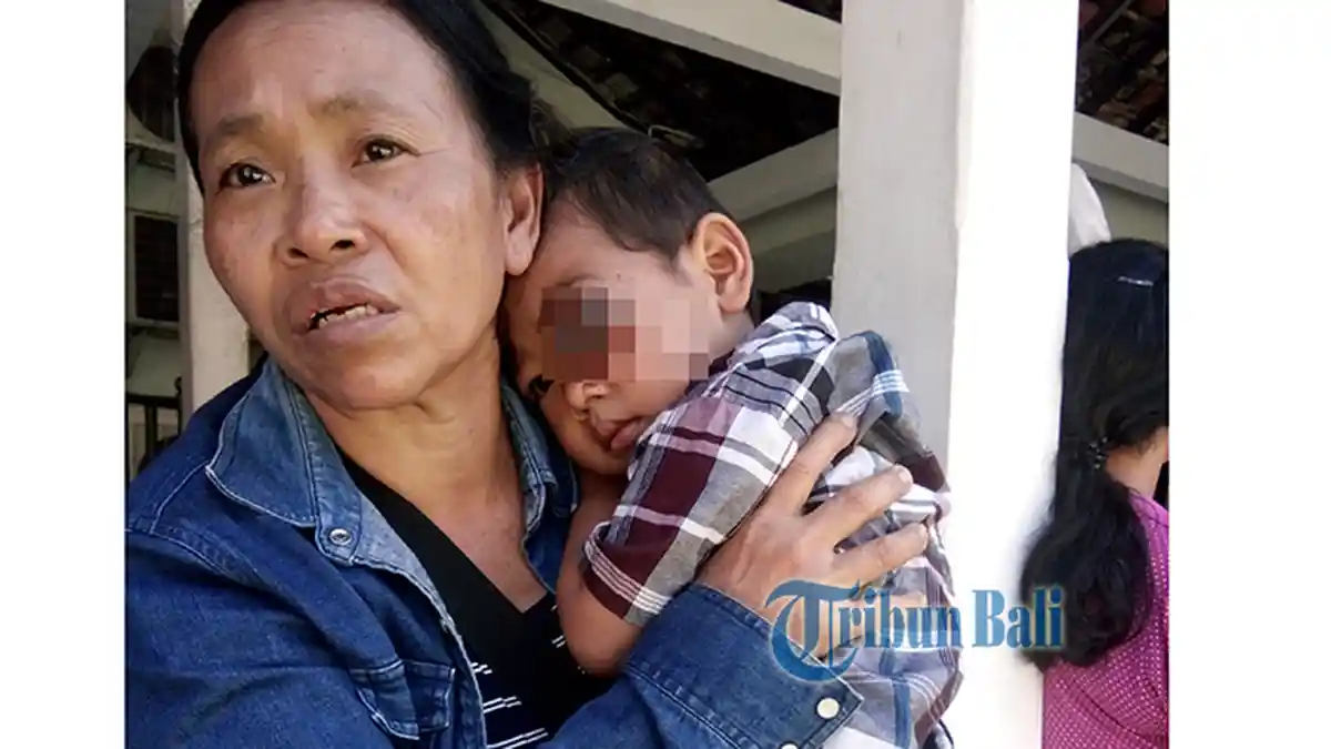 Bocah 2,5 Tahun Putu Adityawan  Mengidap Tumor Mata Stadium Lanjut, Awalnya Dikira Panas Biasa