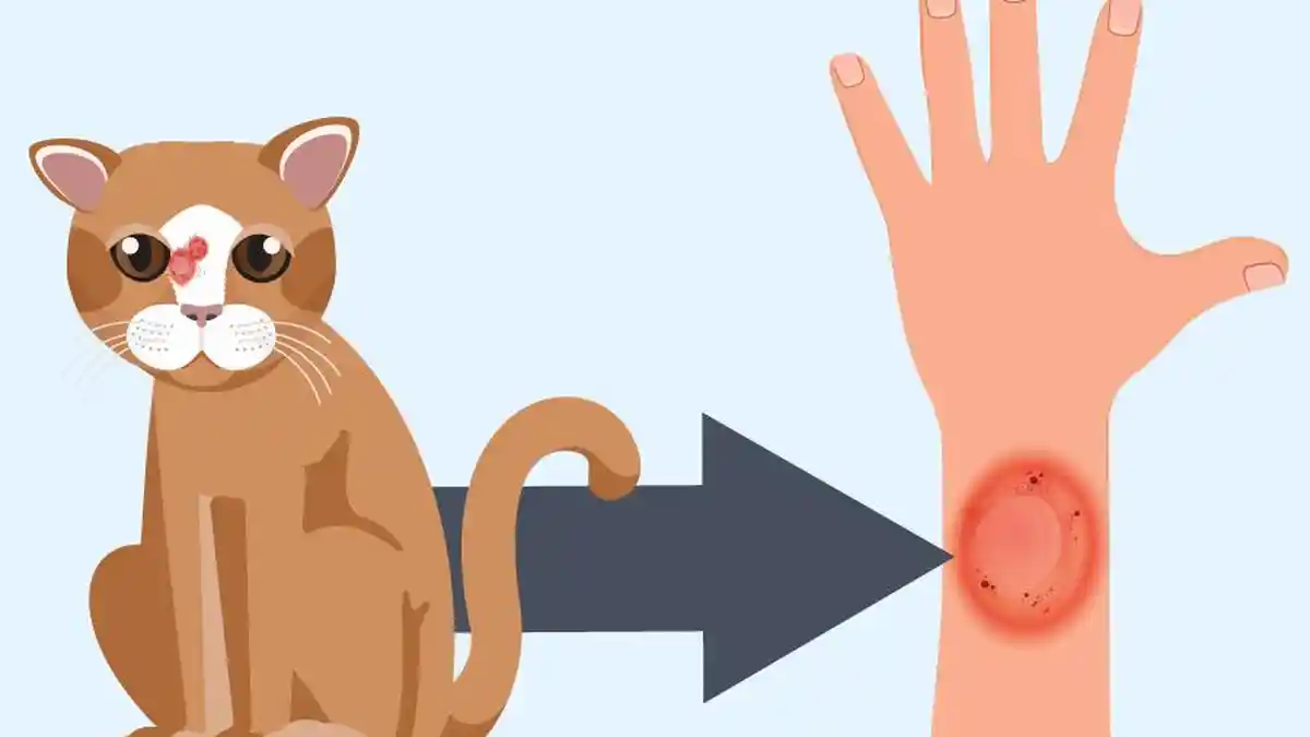 4 Jenis Jamur Ringworm yang Menyerang Manusia, Kucing Bukan Satu-satunya Penyebab Utama