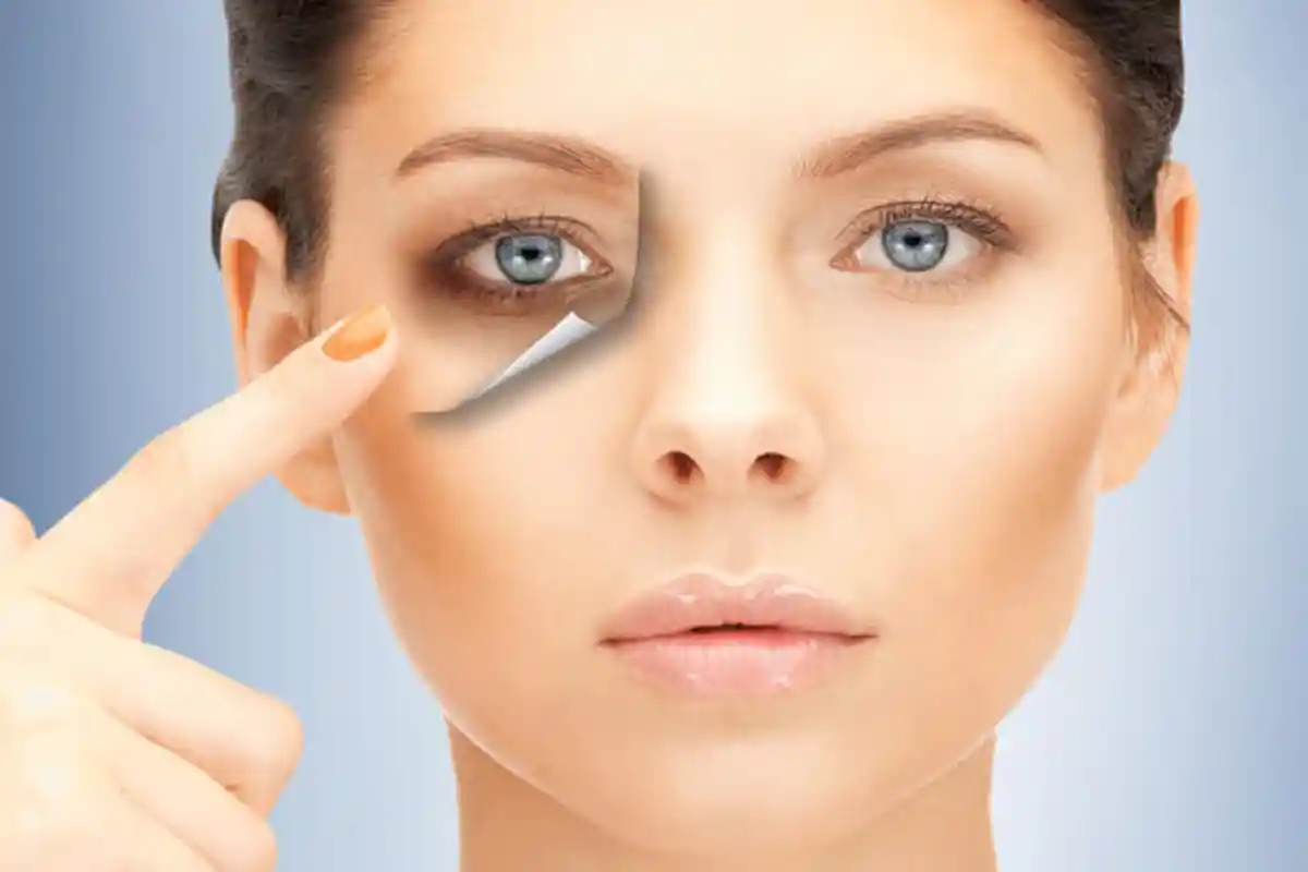 Nggak Mau Keliatan Tua Karena Kerutan di Bawah Mata? Yuk Lakukan Hal Ini