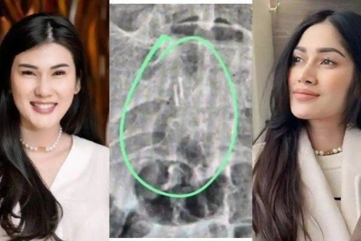 Akui Berseteru dengan Stevie Agnecya, Icha Annisa Akhirnya Blak-blakan Isu Santet Istri Aggi Pratama