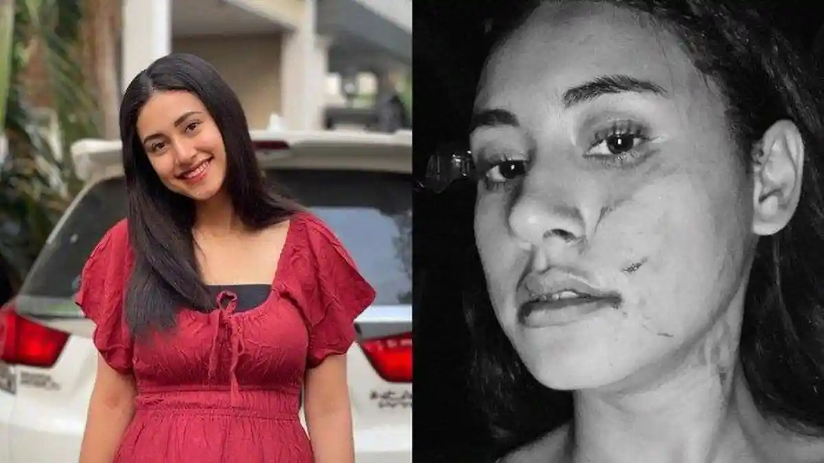 Heboh Selebgram Afifah Riyad Babak Belur Diduga Dianiaya Mantan Pacar Suami, Berawal dari Konten