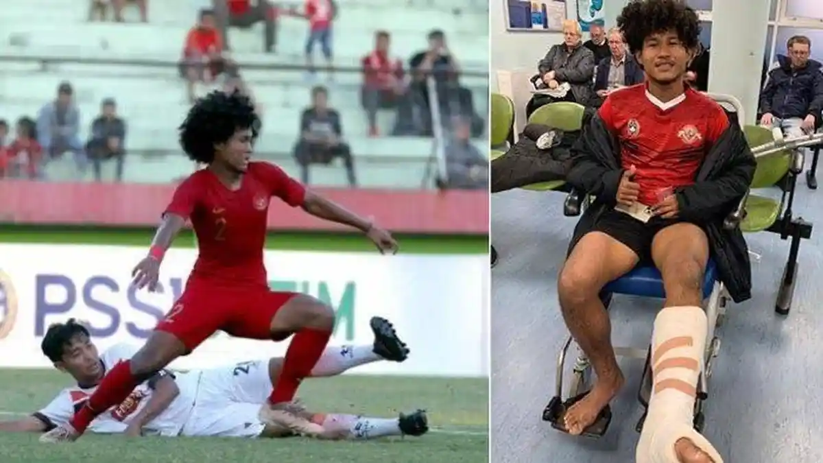 5 Fakta Bagus Kahfi yang Cedera Patah Kaki, Penanganan dari Dokternya David Beckham