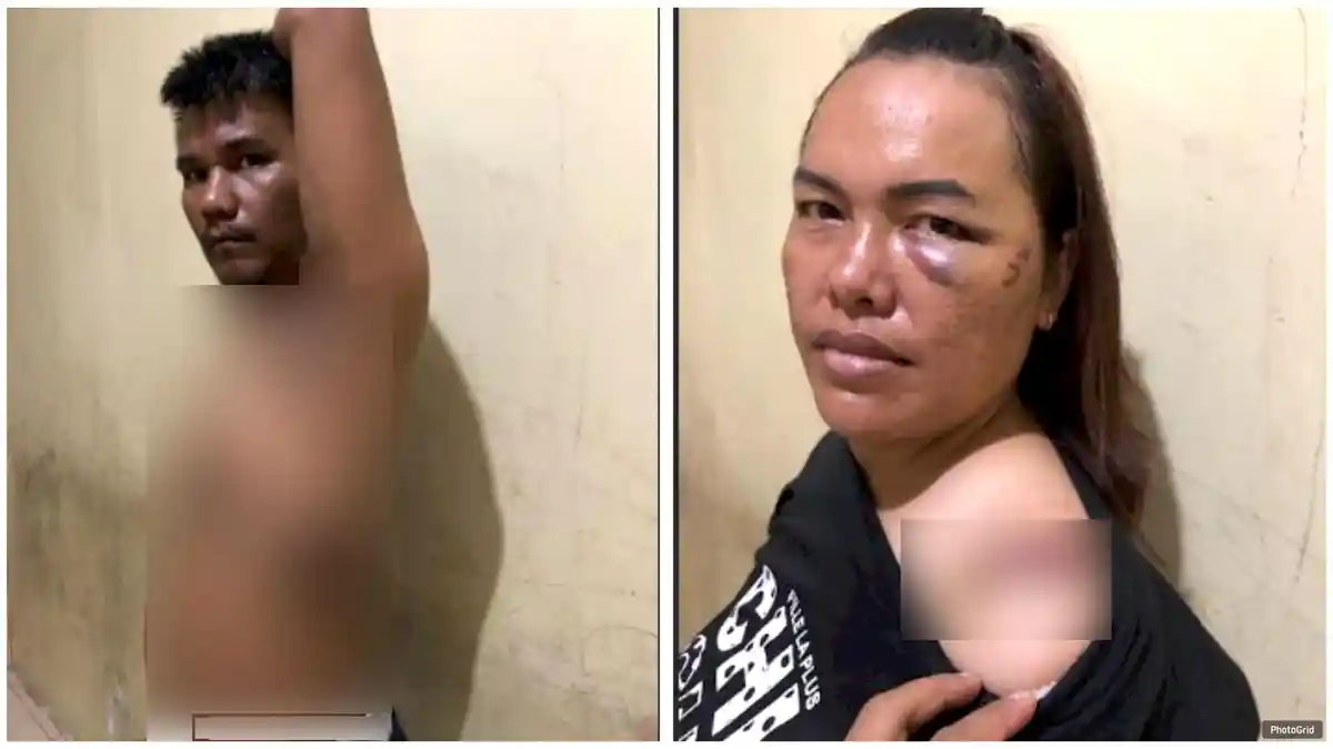 Berawal Terima Gadai Handphone, Pasutri Pemilik Toko HP di Medan Sunggal Dianiaya Orang Tak Dikenal