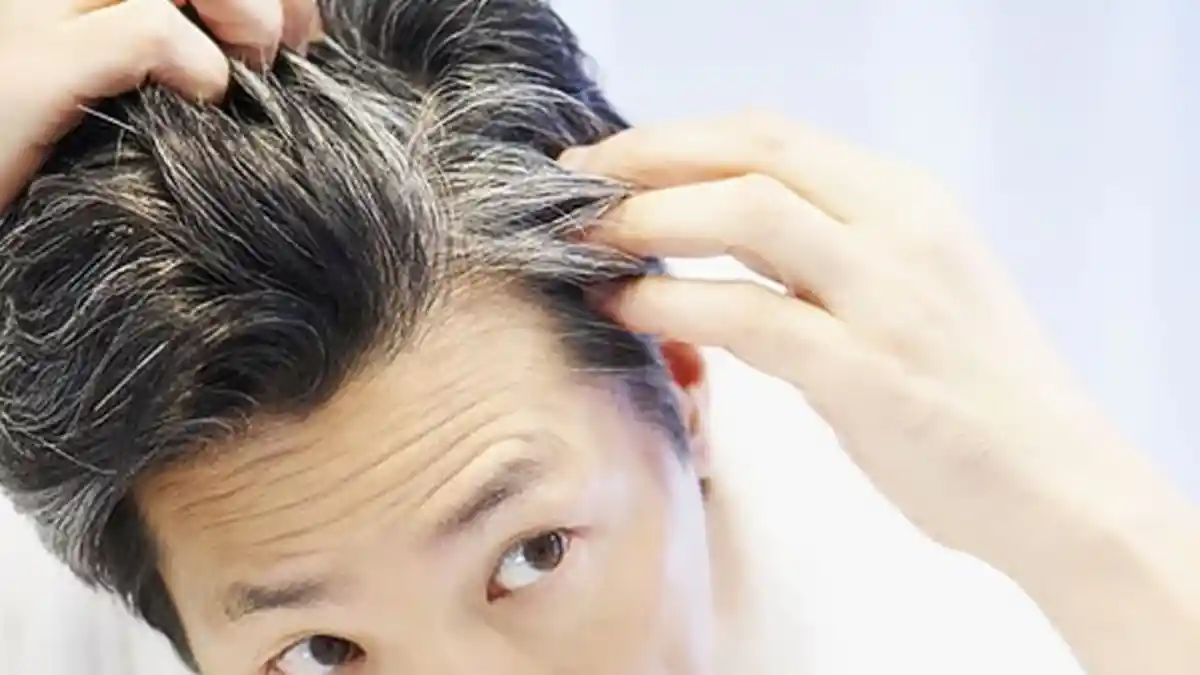 5 Bahan Perawatan Rambut Ini Bisa Mengobati dan Mencegah Rambut Cepat Beruban