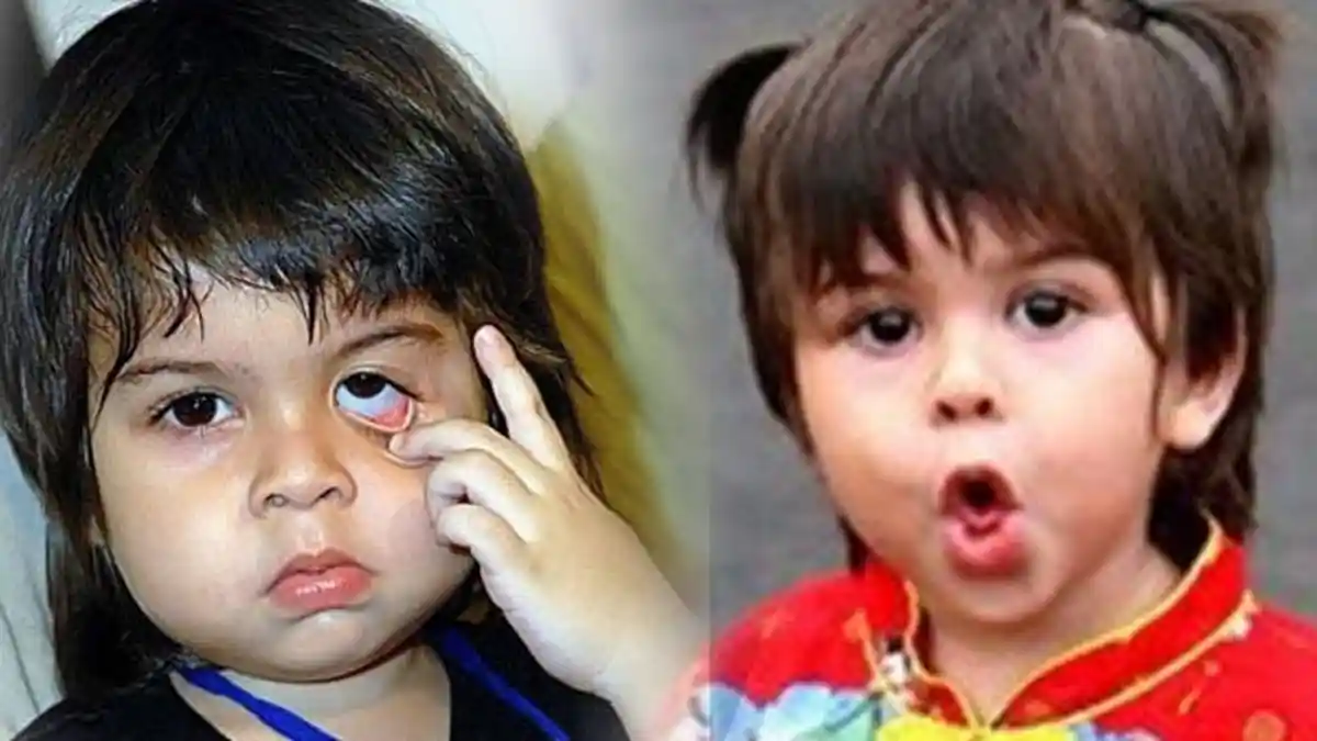 Dulu Tenar Dipuja Banyak Orang, Begini Kabar Terbaru Si Baim Cilik, Sosoknya Bikin Netter Terkejut