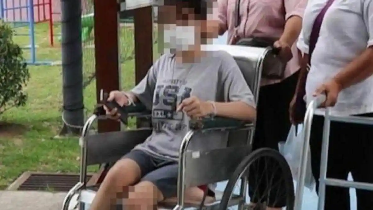 Remaja 16 Tahun Minta Uang Ganti Rugi Rp170 Juta ke Ibu, Alami Kecelakaan hingga Kehilangan Kaki