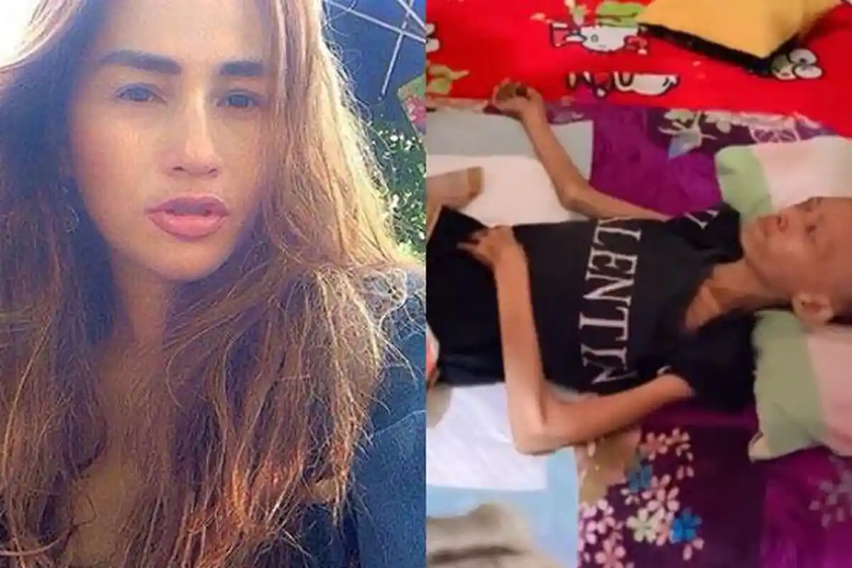 Nasib Pedangdut Diisukan Sakit Parah sampai Kurus, Terungkap Kondisi Sebenarnya: Alhamdulillah