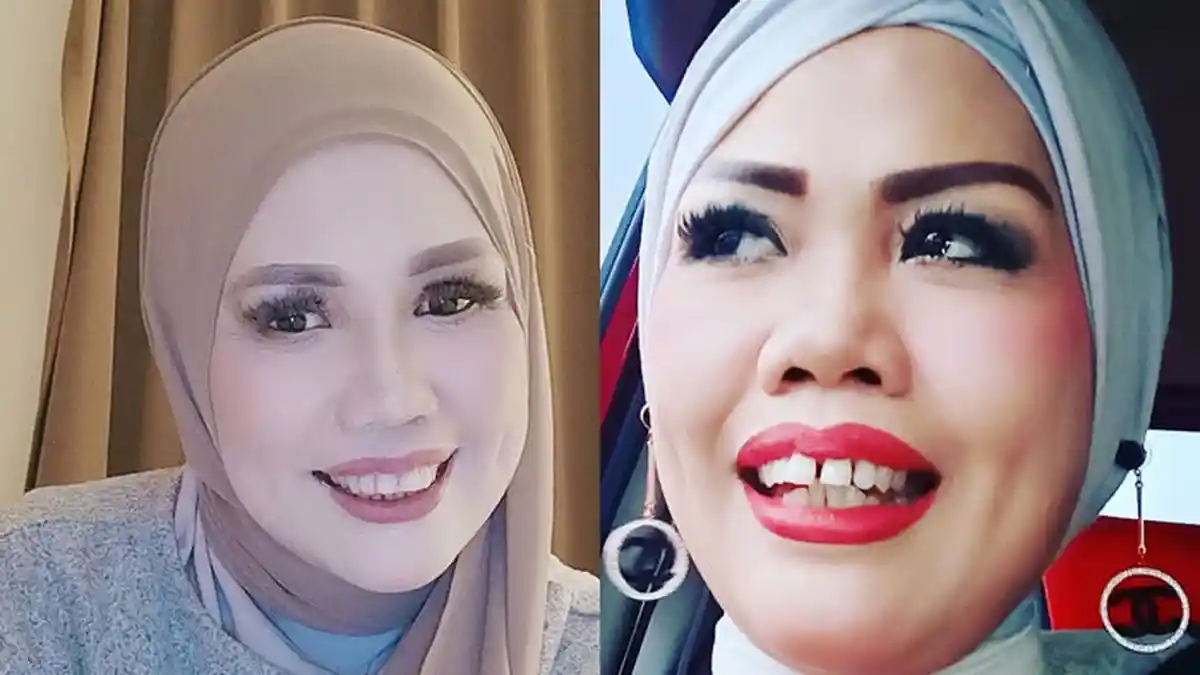 Transformasi Elly Sugigi setelah Potong Gigi, Makin PD, Mengaku Tak Mau Direndahkan Orang Lain