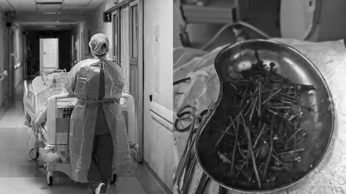 KRONOLOGI Dokter Temukan 1 Kilogram Paku di Perut Seorang Pria