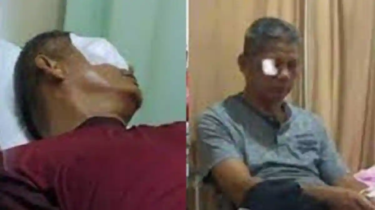 Nasib Zaharman, Ikhlas Matanya Kini Buta Permanen Diketapel Ortu Murid, Anak Minta Pelaku Dihukum