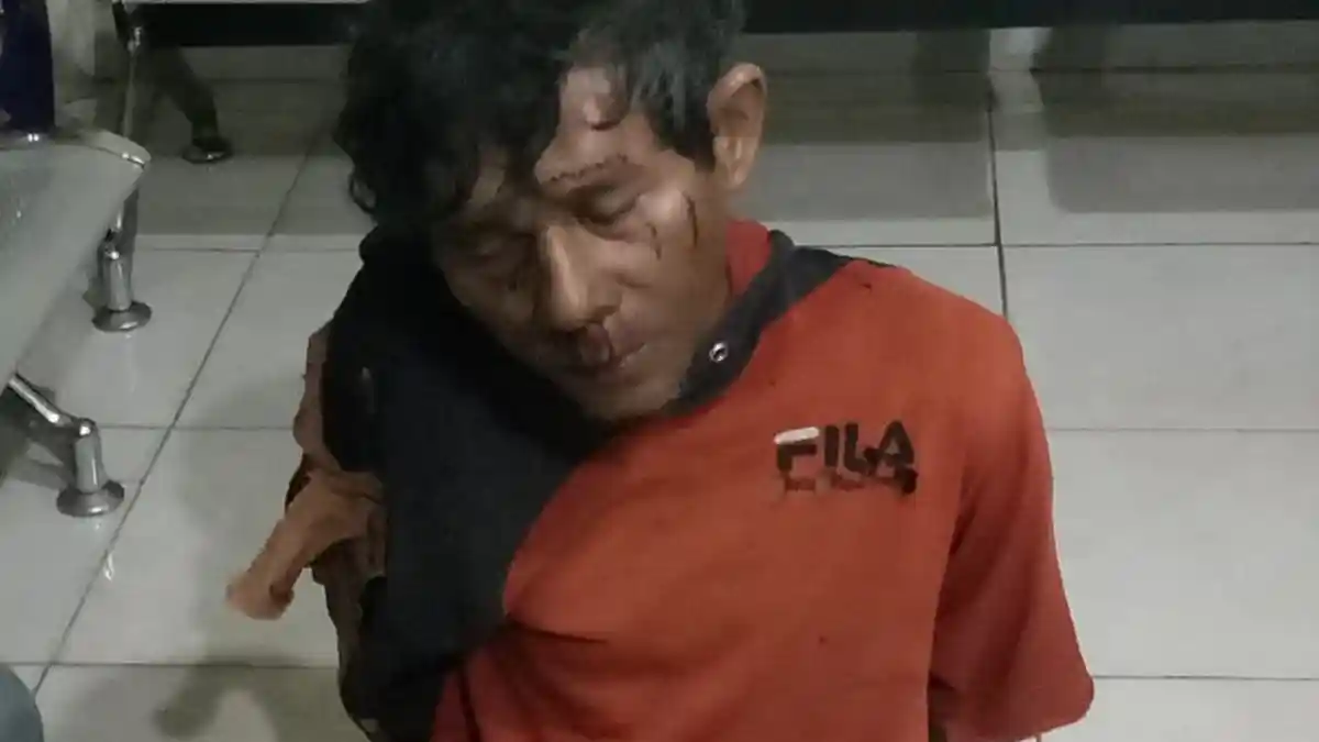 BREAKING NEWS, Imron Warga Palembang Kaget Saat Melintas Disiram Bensin dan Dibakar