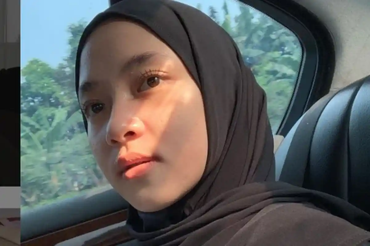 Nissa Sabyan Terbaring dengan Wajah Penuh Perban dan Lengan Bekas Suntik, Ada Apa?