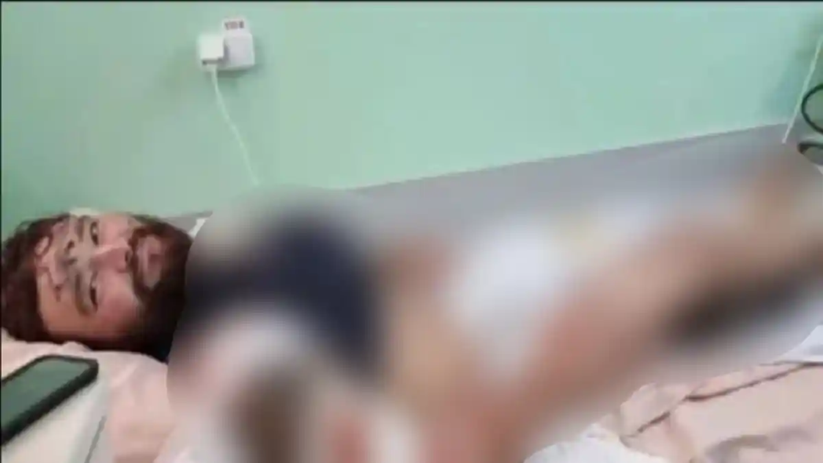 Kepergok Drone Rusia saat Misi Pengintaian, Relawan Inggris Ungkap Detik-detik Dihujani Mortir