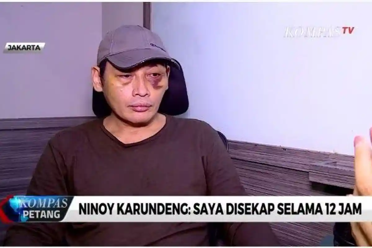 Korban Penganiayaan  Ninoy Karundeng  Mengaku  Trauma, Pelaku Mengancam akan Dipecah Kepalanya