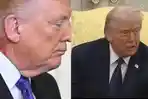 Penyebab Bercak Merah di Leher Donald Trump Dijawab Dokter, Ramai di Tengah Perang yang Memanas