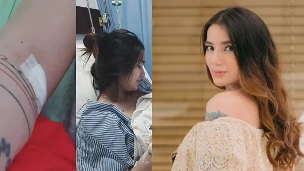 Sheila Marcia Dilarikan ke RS, Keringat Dingin hingga Kuku Membiru, Ternyata Alami Penyakit Ini