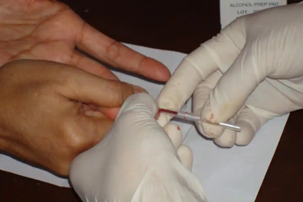 Update Corona Sumba Timur : Satu Pasien Positif Dinyatakan Sembuh