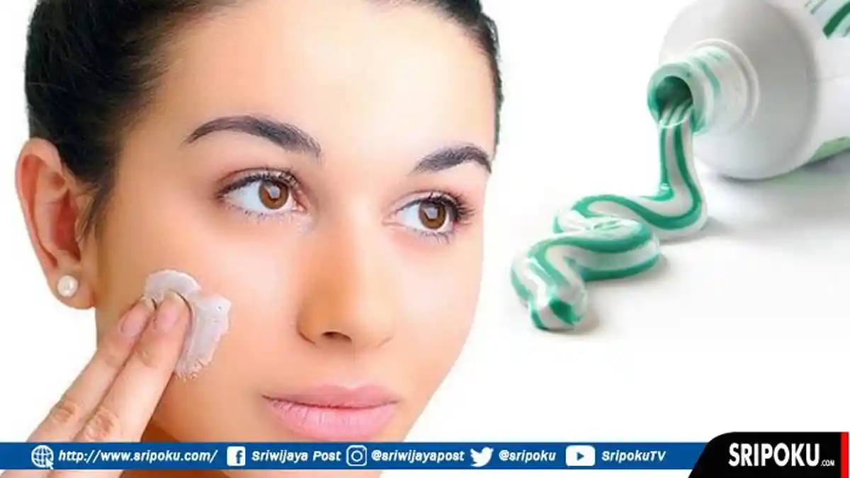 Ternyata Mengobati Jerawat dengan Pasta Gigi Berbahaya Bagi Kulit, Ini Penjelasan Ahli Dermatologi