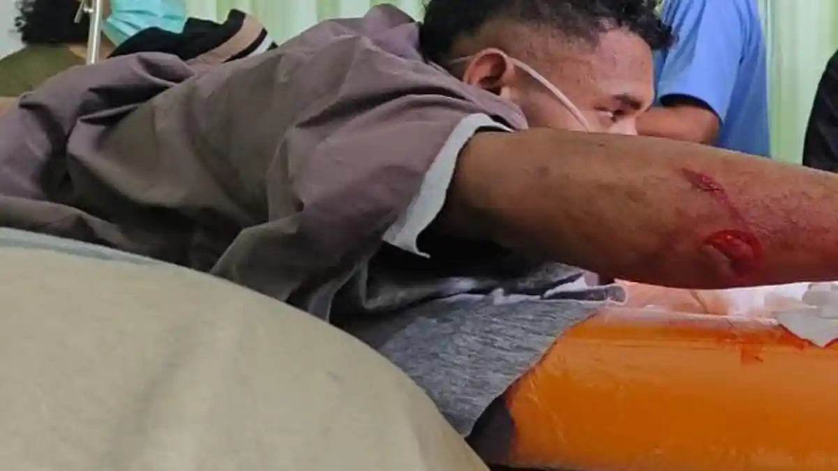 OTK Bacok Babinsa di Pasar Ilaga Puncak, Pinggang dan Tangan Terluka