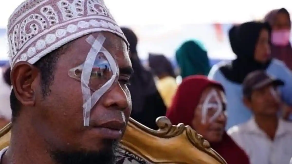 Sebanyak 340 Warga Namlea Maluku Jalani Operasi Katarak Gratis