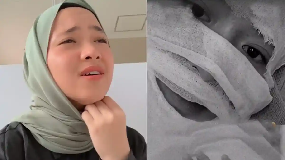 Nissa Sabyan Terbaring Lemas, Seluruh Wajah Dibalut Perban, Kondisi Memprihatinkan, Sakit Apa?