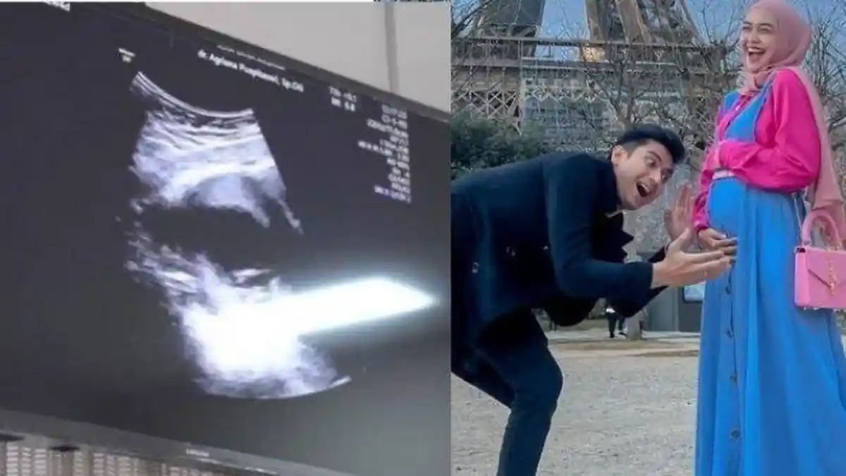 Ria Ricis Siap Melahirkan Dalam Waktu Dekat, Ucap Terima Kasih pada Teuku Ryan