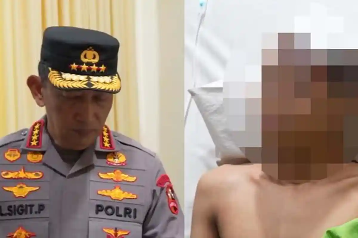 Ekspresi Terduga Pelaku Ledakan SMAN 72 Saat Dijenguk Kapolri, Kondisi Luka FN Usai Operasi Disorot