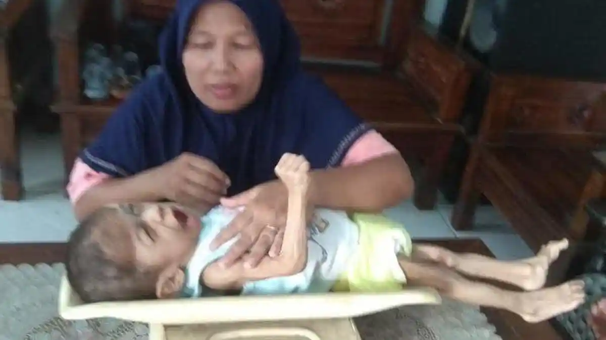 Bocah Mojokerto Berusia 4 Tahun Memiliki Berat Cuma 5,5 Kilogram