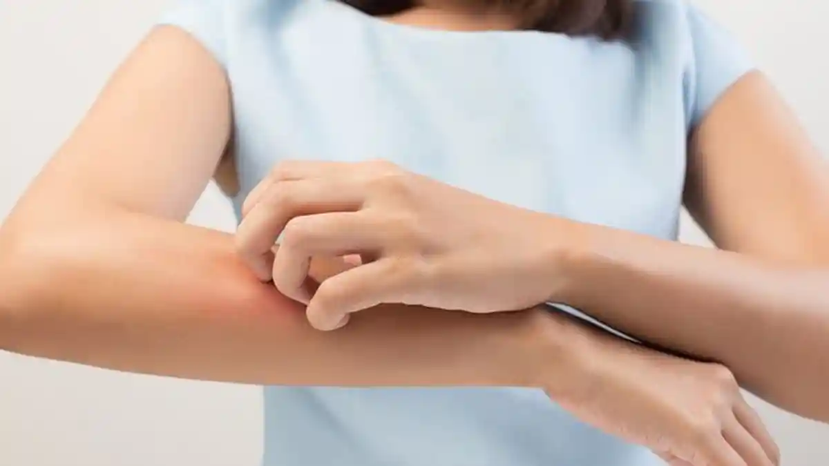 12 Tanda Tubuh Terkena Penyakit Diabetes, Muncul Ini di Kulit