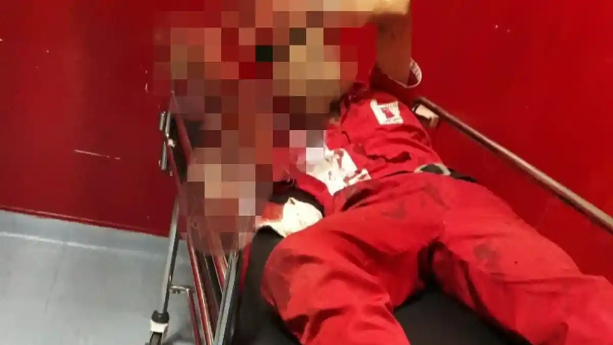 Gara-gara Ditegur Jangan Merokok, Karyawan SPBU di Makassar Dikeroyok, Kepala Nyaris Ditebas Parang