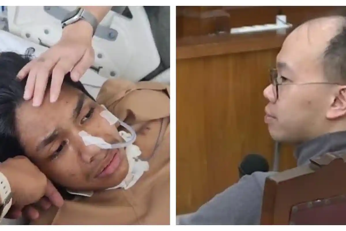 Dokter Tatang: David Ozora Pasien Pertama Diffuse Axonal Injury akibat Pukulan yang Saya Tangani
