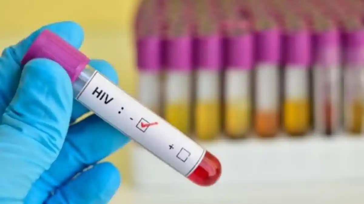 Tekan Angka Penularan HIV/AIDS, Dinkes Jawa Timur Permudah ODHA Dapatkan Obat ARV