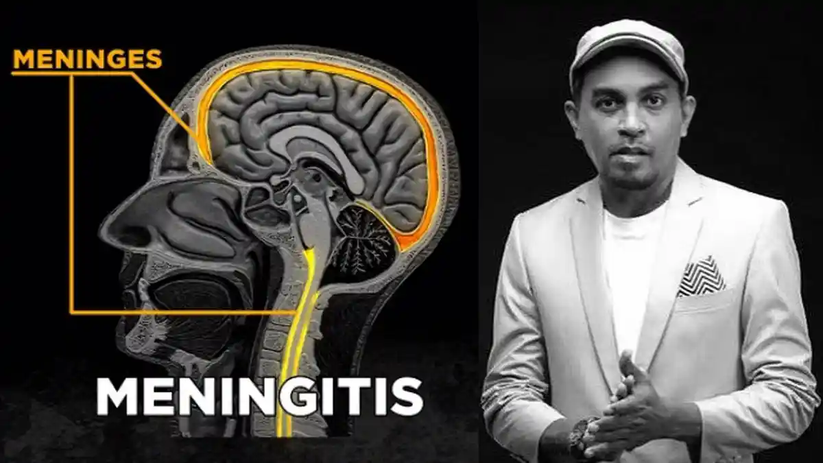 5 Jenis Meningitis, Penyakit yang Sebabkan Glenn Fredly Meninggal, Ada yang Bisa Menular