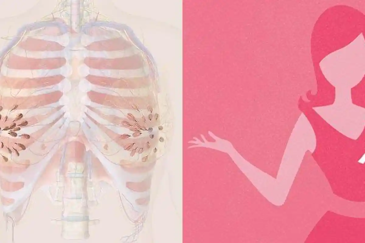 Gejala Kanker Payudara yang Harus Kamu Tahu, Tak Hanya Muncul Benjolan