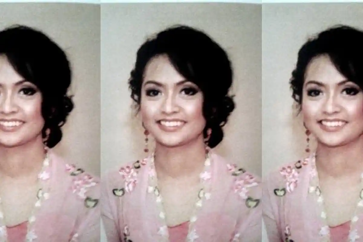 Kisah Wanita S2 Perancis Jadi Korban Malapraktik Klinik Kecantikan