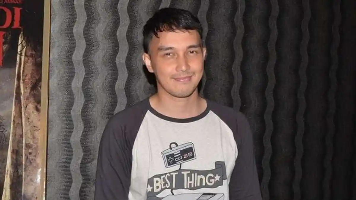 Dimas Aditya Jalani Transplantasi Rambut Gara-gara Rambut Rontok hingga Krisis Percaya Diri