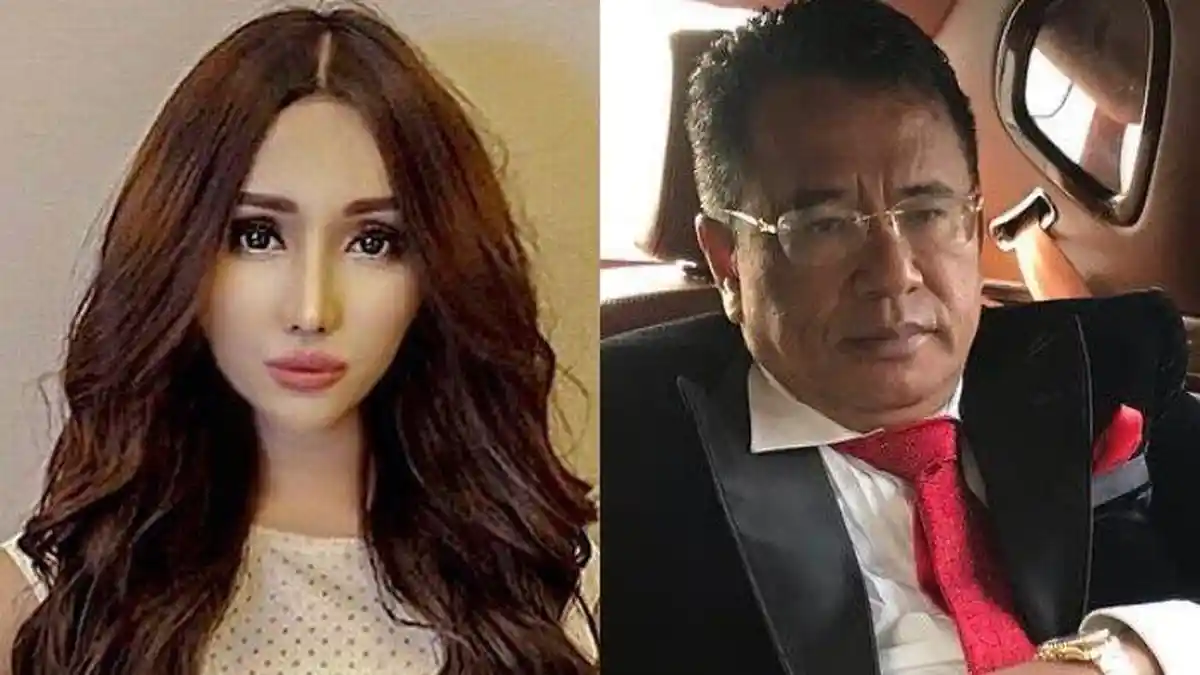 Hotman Paris Kaget, Biaya Operasi Plastik Lucinta Luna Mencapai Rp1 Miliar, Berikut Rinciannya