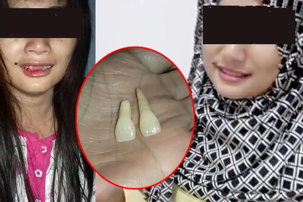 Ditendang Suami Sampai Ompong, Curhat Wanita Ini Bikin Terenyuh