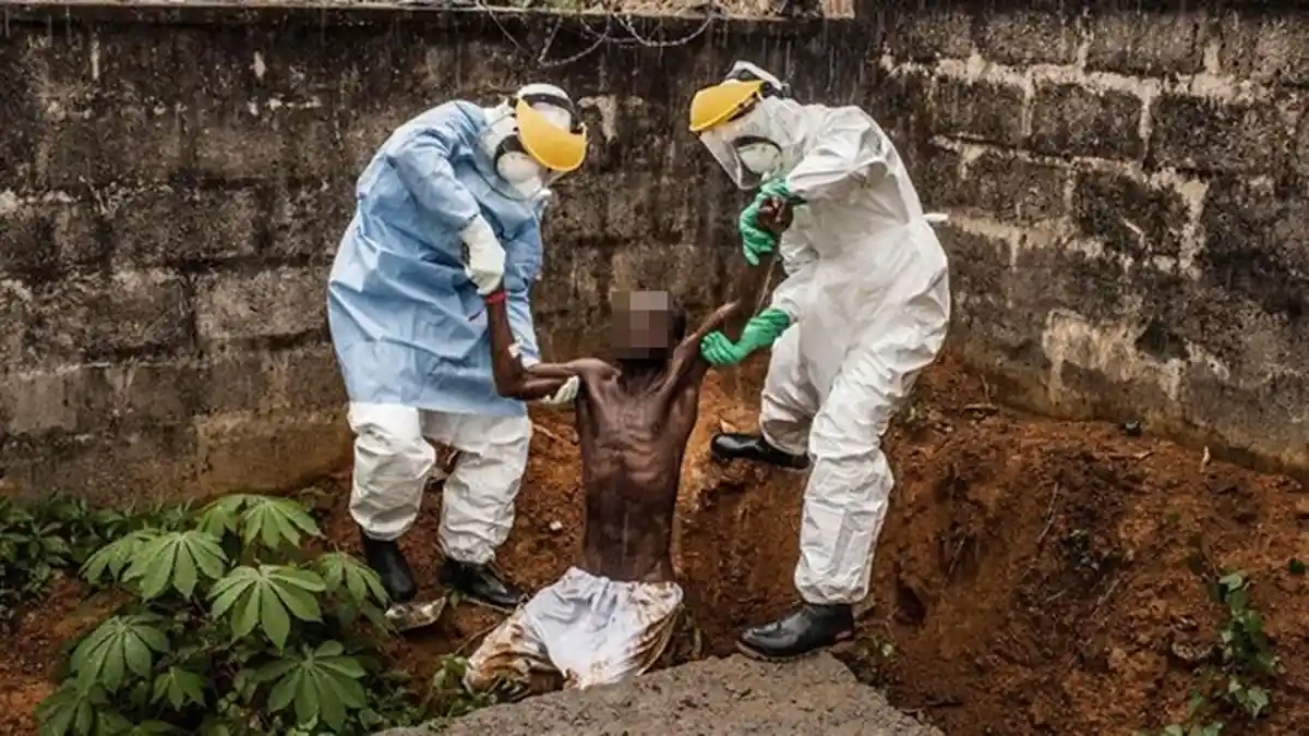 Penyakit Misterius Serang Afrika, 15 Orang Meninggal dalam Waktu 48 Jam, Begini Ciri-ciri Infeksinya