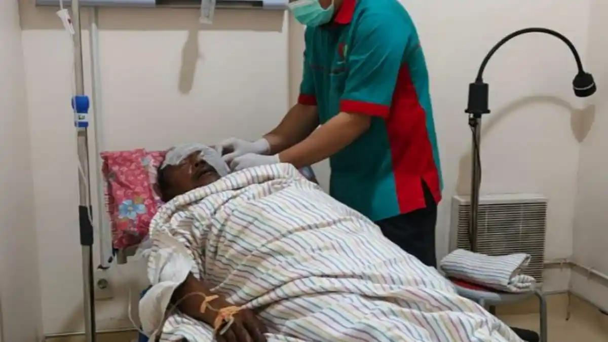 Sopir Alami Luka Bakar saat Kebakaran di Tanjakan Way Sekampung Pringsewu