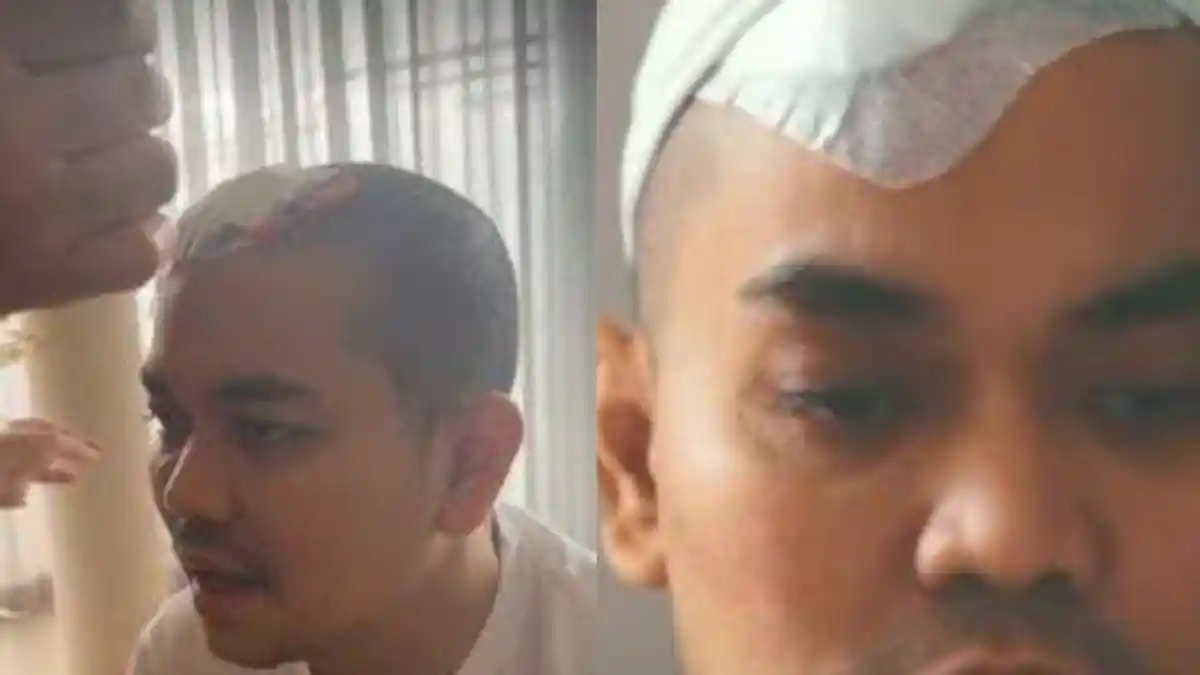 Ternyata Indra Bekti Marah Besai Usai Pulang dari RS, Adilla Jelita Ungkap Penyebabnya