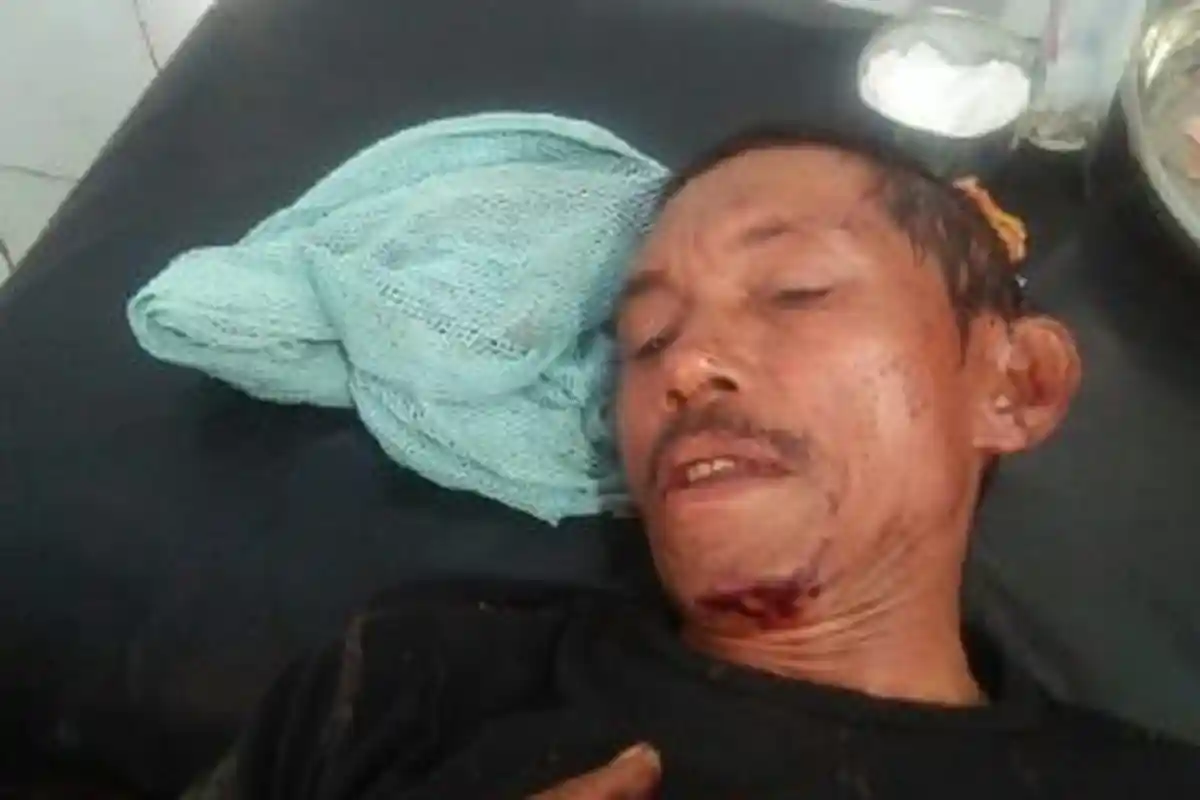 Gara-Gara Rebutan Tanah di Borong! Fransiskus Bacok Urbanus di Persawahan Golo