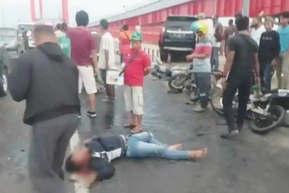 Kecelakaan Pukul 05.30, Imron Luka Parah Tangan dan Kaki Kiri Patah Ditabrak Mobil hingga Terpental