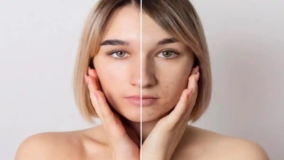 dr Desidera Paparkan Ciri-ciri Skin Barrier Rusak dan Cara Cegah Kerusakan Agar Tak Semakin Parah